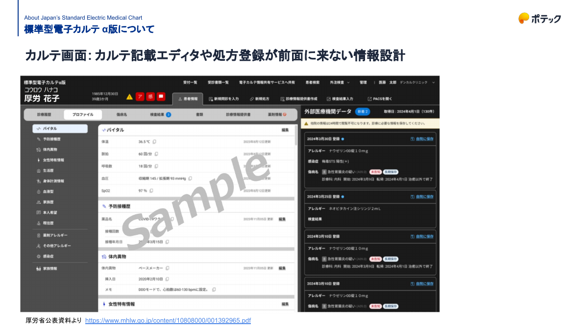 Chart screen of the standard EMR alpha